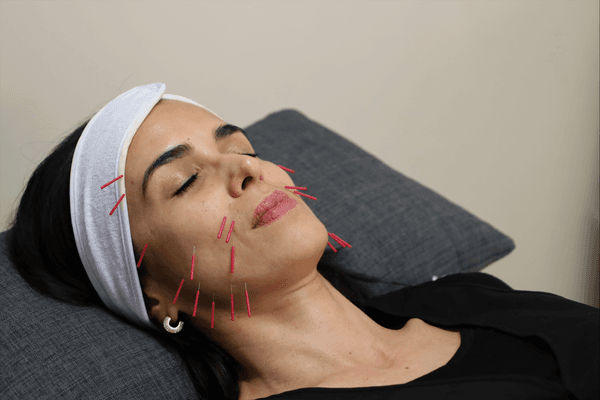 Feel Good Acupuncture & Wellness — Acupuncturists in Albert-Eden