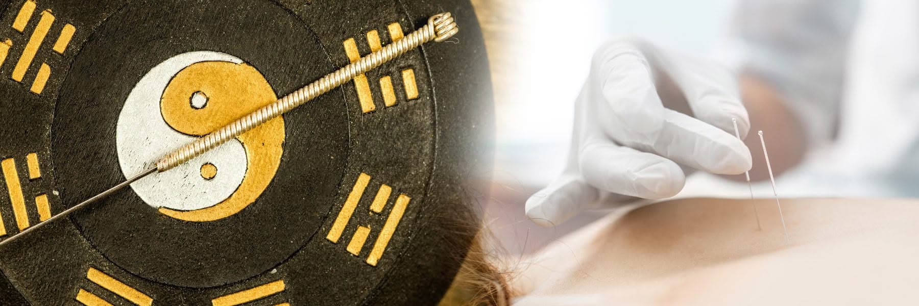The Health Clinic — Acupuncturists in Grey Lynn