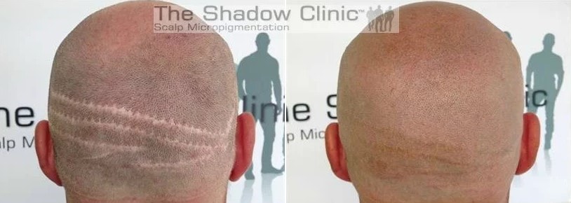 The Shadow Clinic Christchurch — Tattoo & Piercing Shops in Christchurch