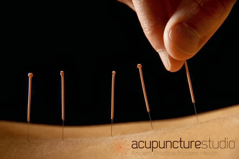 Pt Chevalier Chiropractic — Chiropractors in Auckland