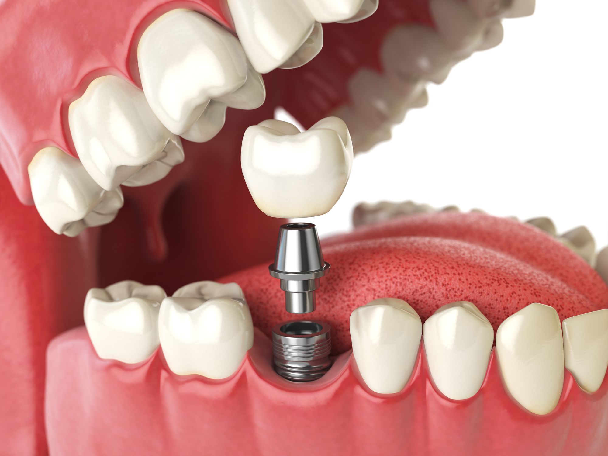 Dental Care Pakuranga — Dentists in Howick