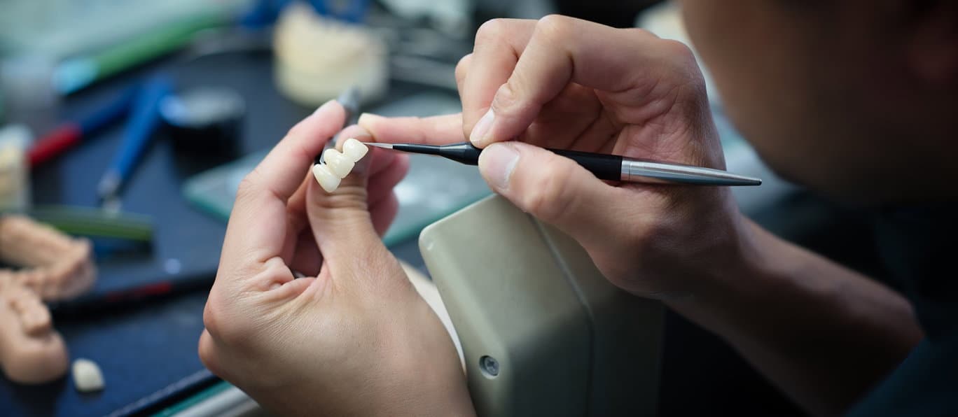Advanced Ceramics — Dentists in Christchurch
