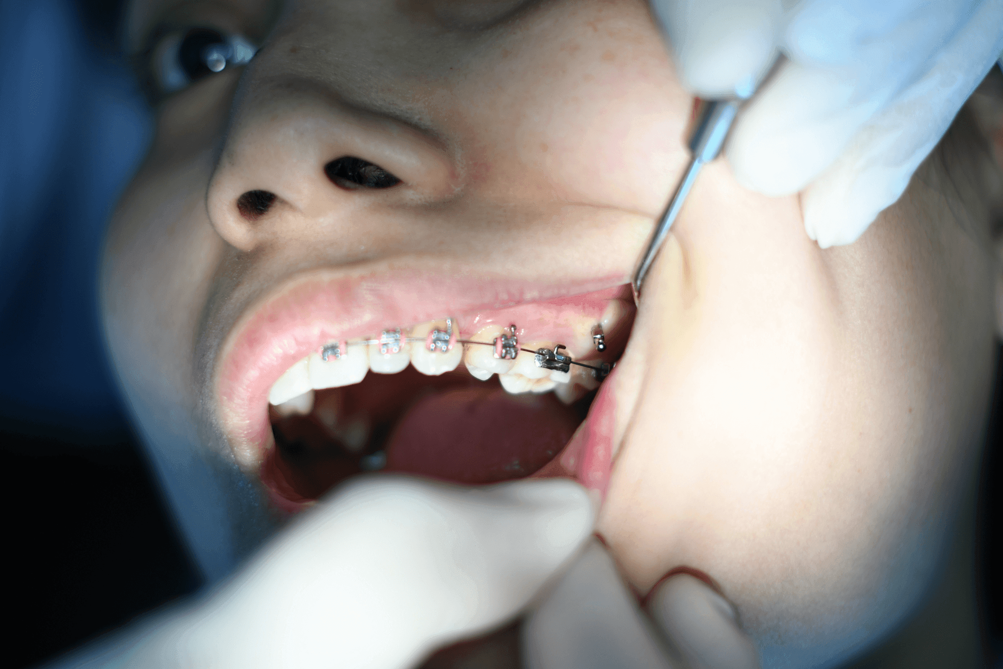Viva Dental Care — Dentists in Puketāpapa