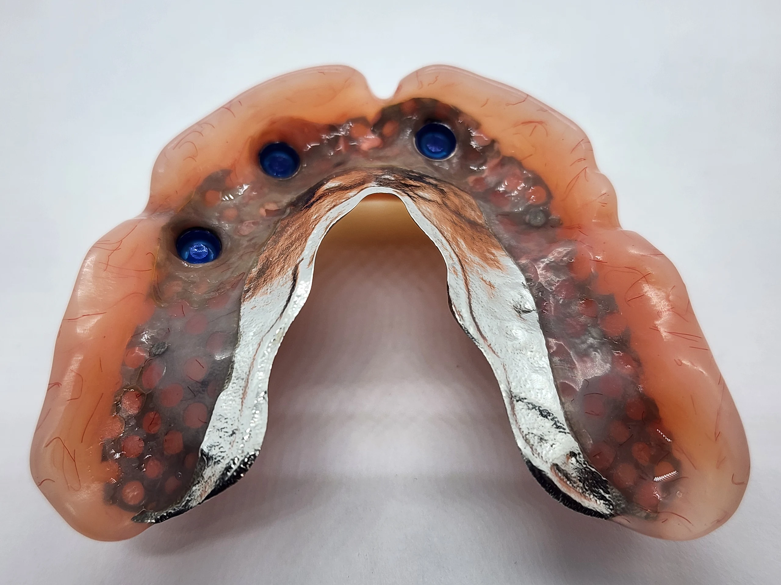 Designer Dentures — Dentists in Ōtara-Papatoetoe