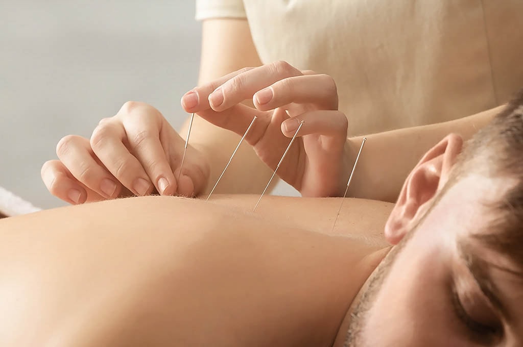 Pro Acupuncture Auckland Branch — Acupuncturists in Dunedin