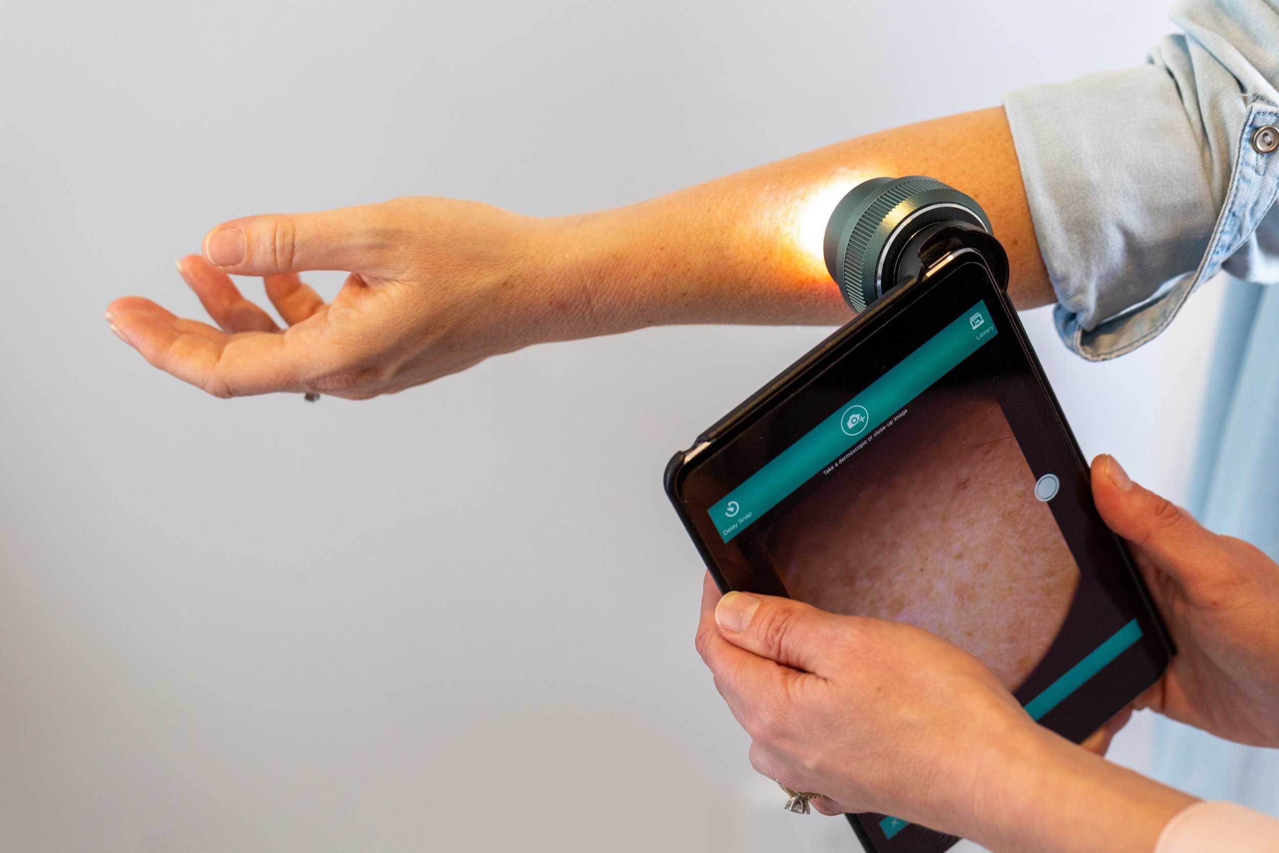Mole Doctors — Medical Centres in Auckland