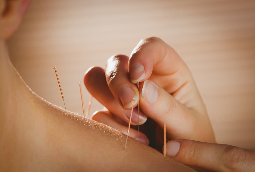 Graham Good Acupuncture — Acupuncturists in Timaru