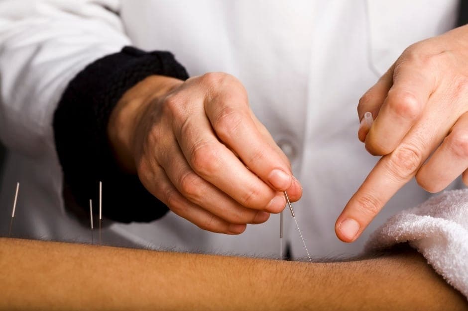 Acupuncturists on Business Directory